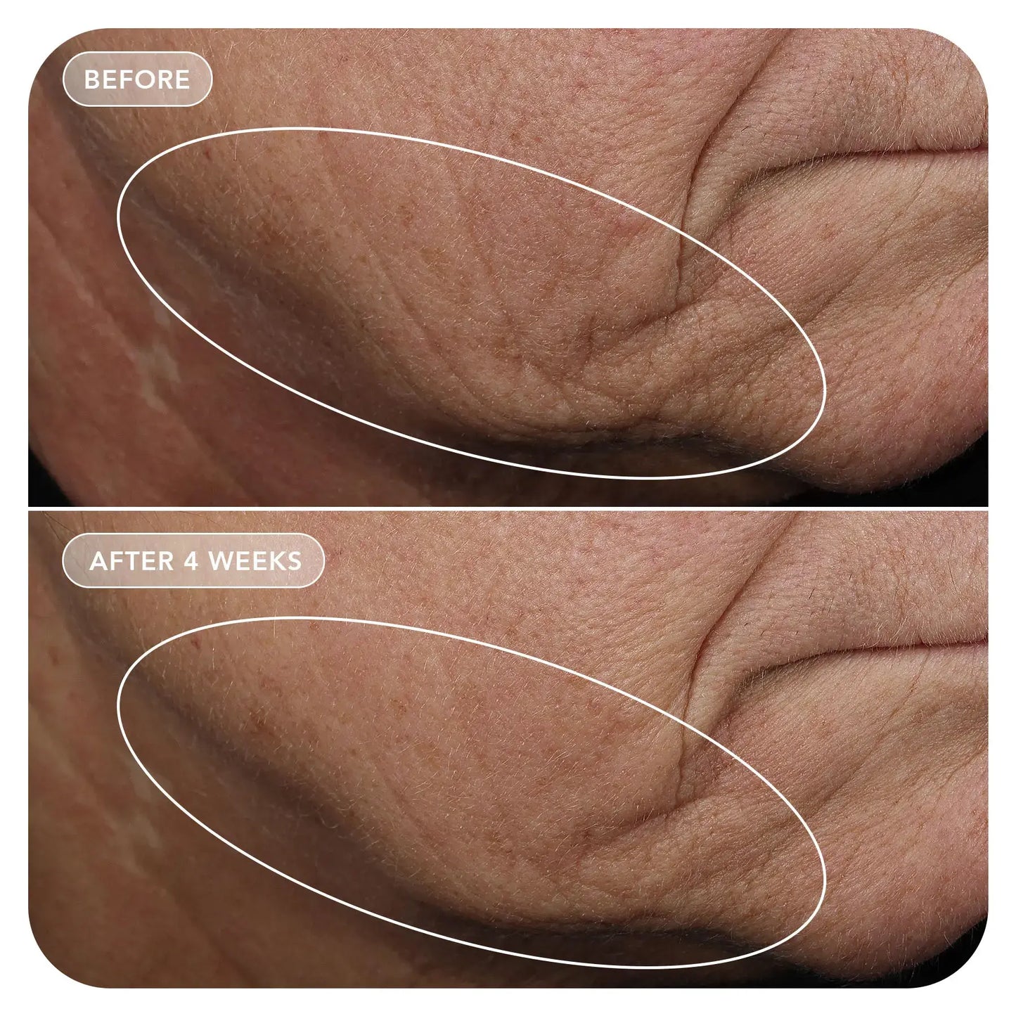 VOL.U.LIFT™ GLP-1 4D Skin Rebound Complex